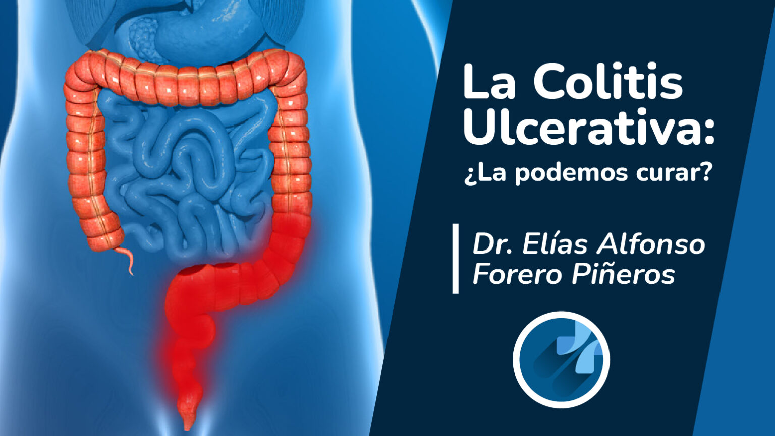 Colitis Ulcerativa Consulta de Gastroenterología Psicosomática