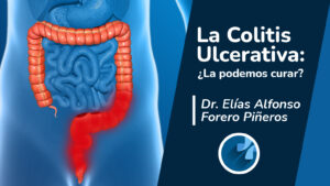 Colitis Ulcerativa | Consulta de gastroenterologia Psicosomatica