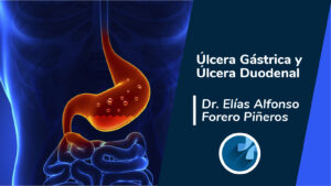 Úlcera gástrica y úlcera duodenal