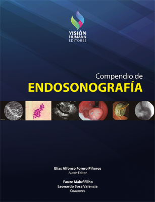 Endosonografía