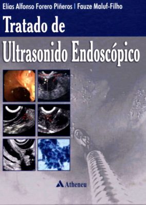 Ultrasonido Endoscópico | Gastroenterólogo Bogotá